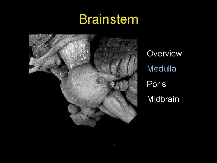 Brainstem Overview Medulla Pons Midbrain . 