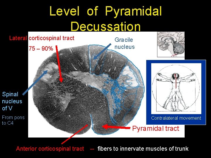 Level of Pyramidal Decussation Lateral corticospinal tract 75 – 90% Gracile nucleus Spinal nucleus