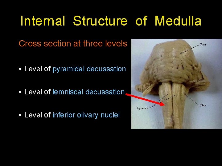 Internal Structure of Medulla Cross section at three levels • Level of pyramidal decussation