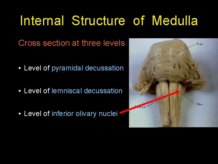 Internal Structure of Medulla Cross section at three levels • Level of pyramidal decussation