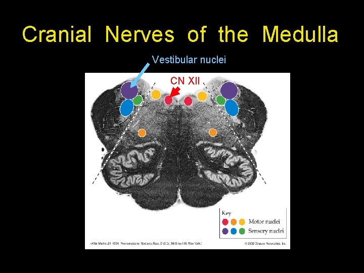 Cranial Nerves of the Medulla Vestibular nuclei CN XII 