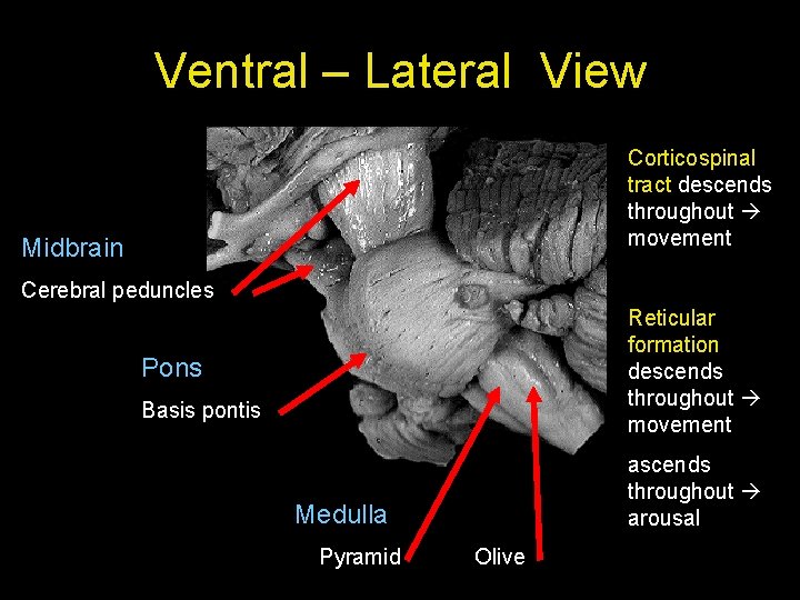 Ventral – Lateral View Corticospinal tract descends throughout movement Midbrain Cerebral peduncles Reticular formation