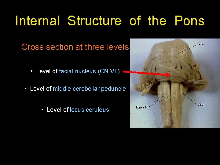 Internal Structure of the Pons Cross section at three levels • Level of facial