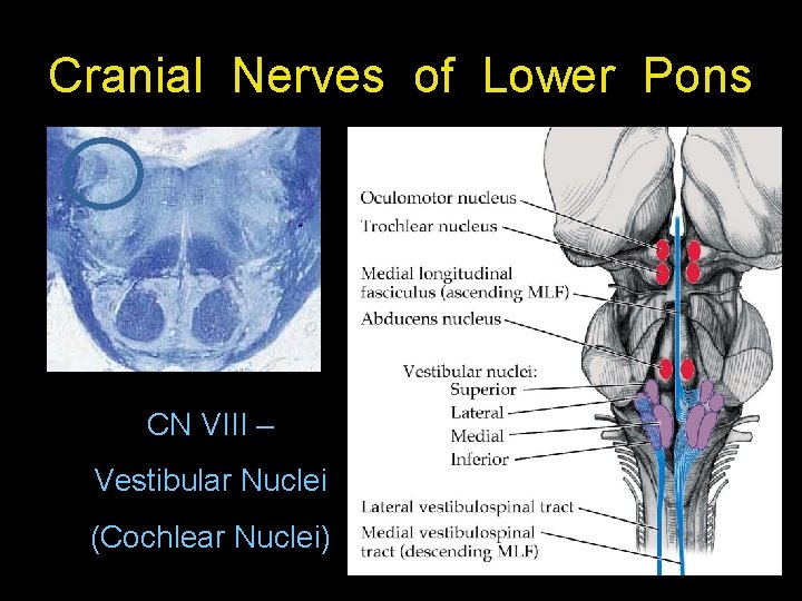 Cranial Nerves of Lower Pons CN VIII – Vestibular Nuclei (Cochlear Nuclei) 