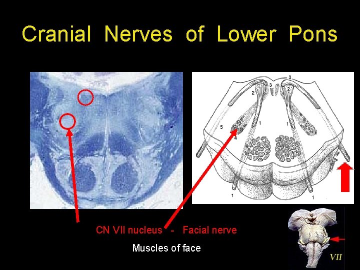 Cranial Nerves of Lower Pons CN VII nucleus - Facial nerve Muscles of face