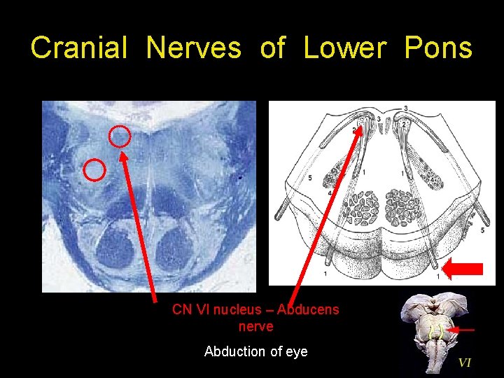 Cranial Nerves of Lower Pons CN VI nucleus – Abducens nerve Abduction of eye