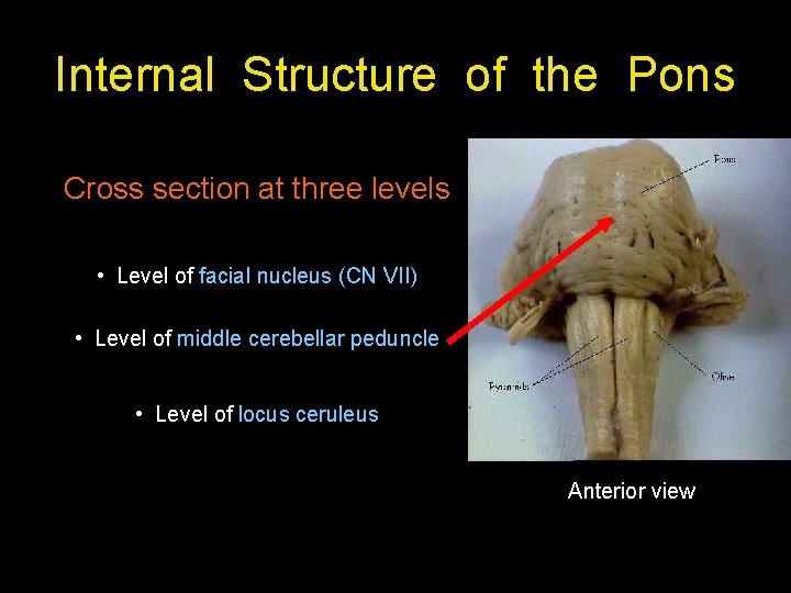 Internal Structure of the Pons Cross section at three levels • Level of facial