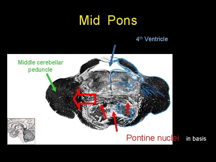 Mid Pons 4 th Ventricle Middle cerebellar peduncle Pontine nuclei in basis 