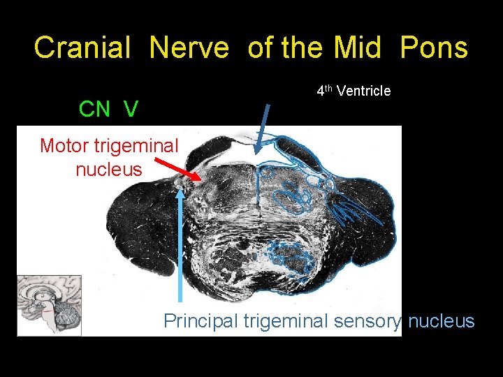 Cranial Nerve of the Mid Pons 4 th Ventricle CN V Motor trigeminal nucleus