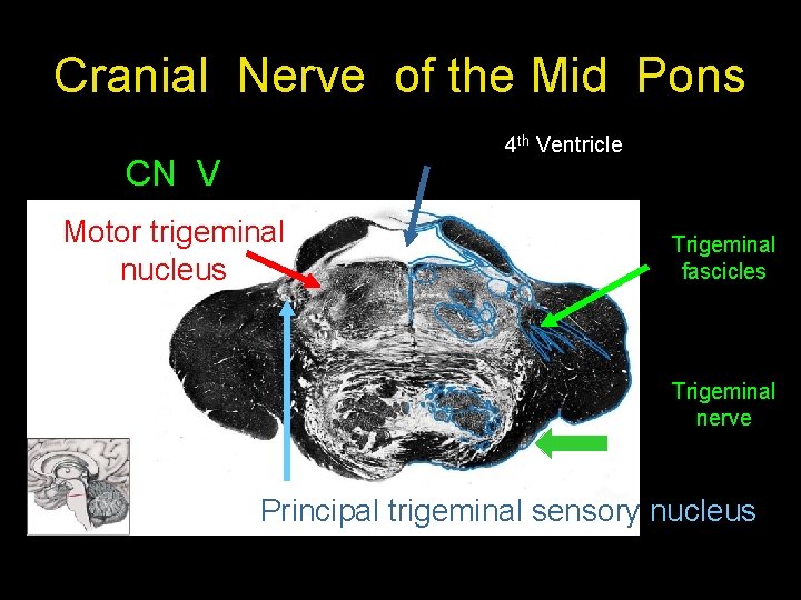 Cranial Nerve of the Mid Pons 4 th Ventricle CN V Motor trigeminal nucleus