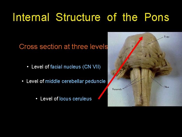 Internal Structure of the Pons Cross section at three levels • Level of facial