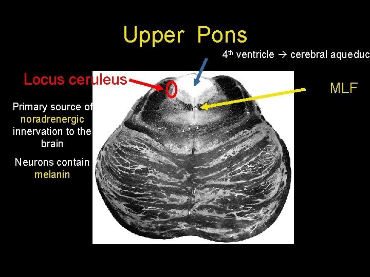 Upper Pons 4 th ventricle cerebral aqueduct Locus ceruleus Primary source of noradrenergic innervation