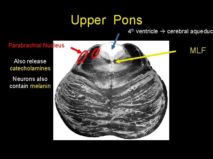 Upper Pons 4 th ventricle cerebral aqueduct Parabrachial Nucleus Also release catecholamines Neurons also