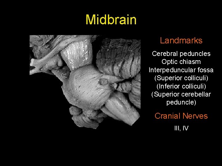 Midbrain Landmarks Cerebral peduncles Optic chiasm Interpeduncular fossa (Superior colliculi) (Inferior colliculi) (Superior cerebellar