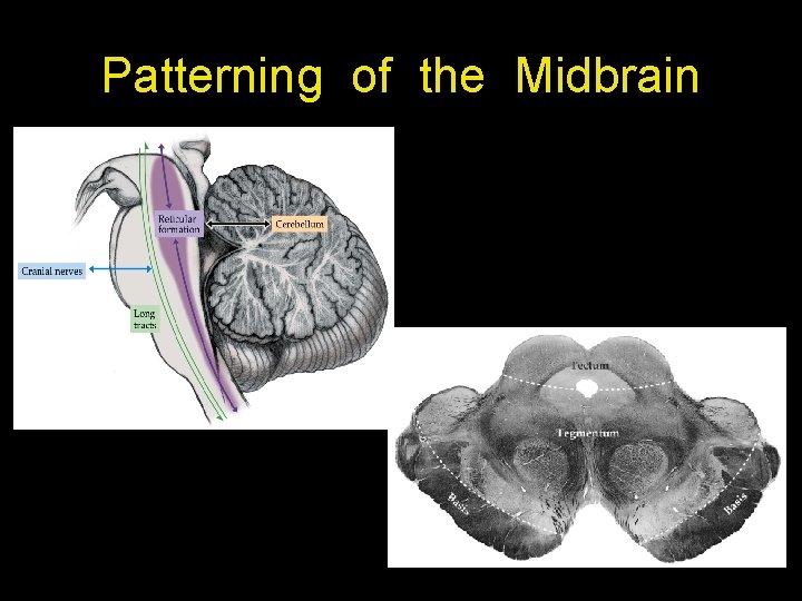 Patterning of the Midbrain 