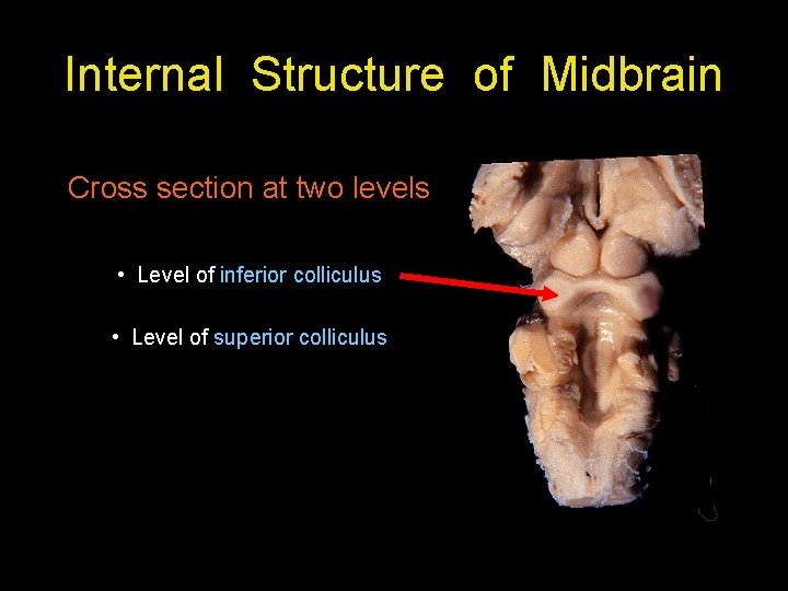 Internal Structure of Midbrain Cross section at two levels • Level of inferior colliculus