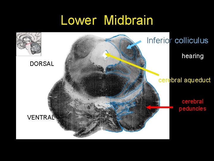 Lower Midbrain Inferior colliculus hearing DORSAL cerebral aqueduct cerebral peduncles VENTRAL 