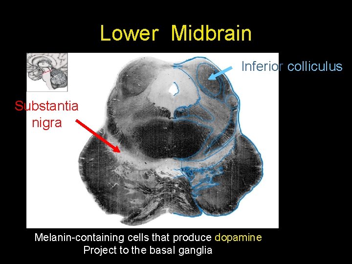 Lower Midbrain Inferior colliculus Substantia nigra Melanin-containing cells that produce dopamine Project to the