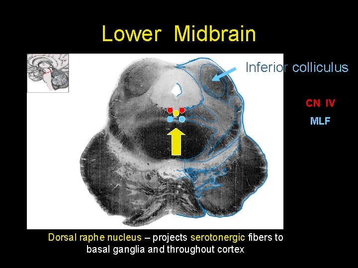 Lower Midbrain Inferior colliculus CN IV MLF Dorsal raphe nucleus – projects serotonergic fibers