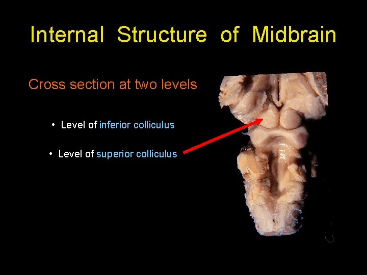 Internal Structure of Midbrain Cross section at two levels • Level of inferior colliculus