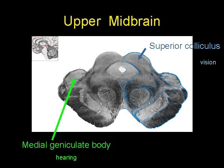 Upper Midbrain Superior colliculus vision Medial geniculate body hearing 