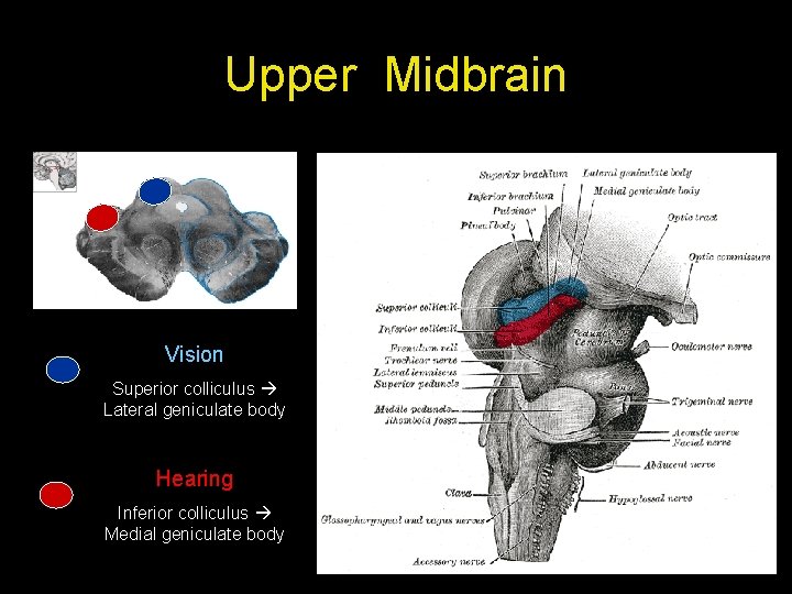 Upper Midbrain Vision Superior colliculus Lateral geniculate body Hearing Inferior colliculus Medial geniculate body