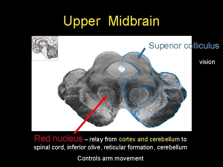 Upper Midbrain Superior colliculus vision Red nucleus – relay from cortex and cerebellum to