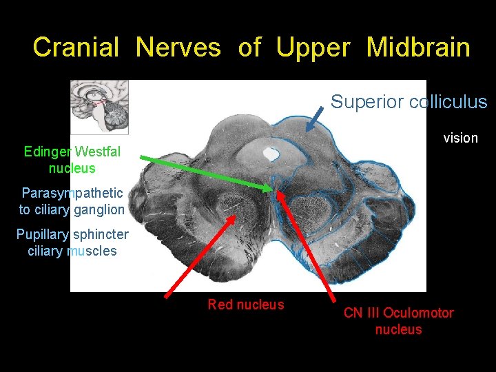 Cranial Nerves of Upper Midbrain Superior colliculus vision Edinger Westfal nucleus Parasympathetic to ciliary