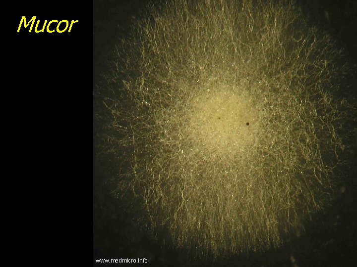 Mucor www. medmicro. info 