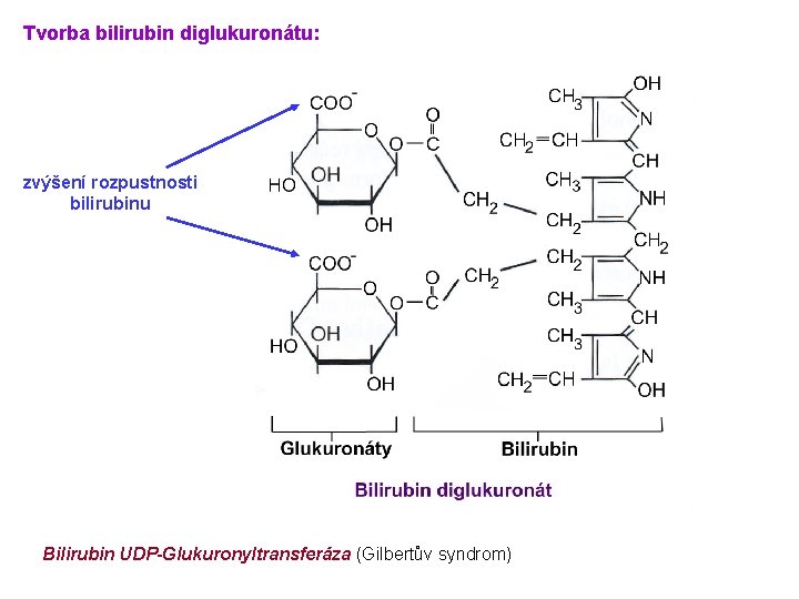 Tvorba bilirubin diglukuronátu: zvýšení rozpustnosti bilirubinu Bilirubin UDP-Glukuronyltransferáza (Gilbertův syndrom) 