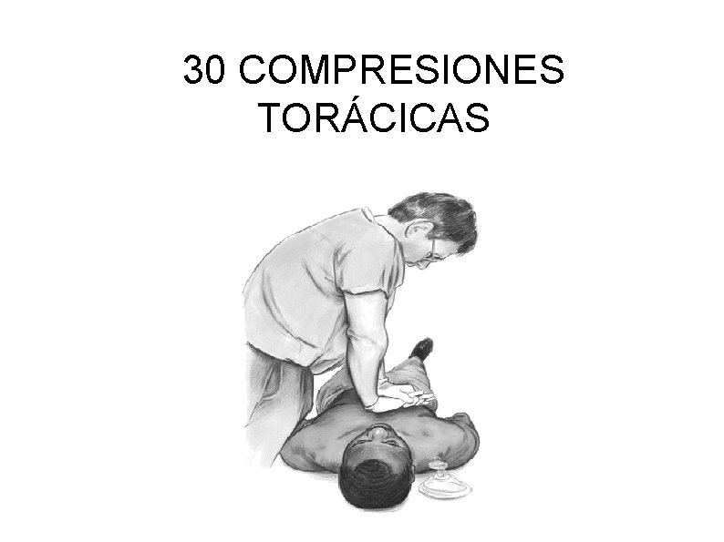 30 COMPRESIONES TORÁCICAS 