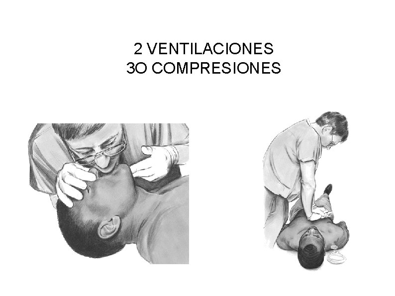 2 VENTILACIONES 3 O COMPRESIONES 