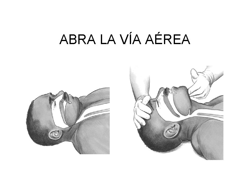 ABRA LA VÍA AÉREA 