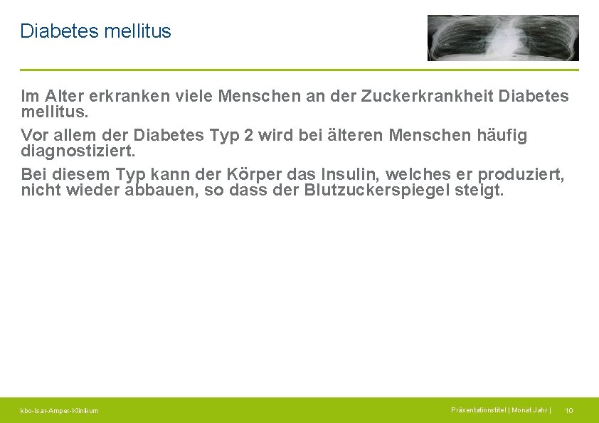 Diabetes mellitus Im Alter erkranken viele Menschen an der Zuckerkrankheit Diabetes mellitus. Vor allem