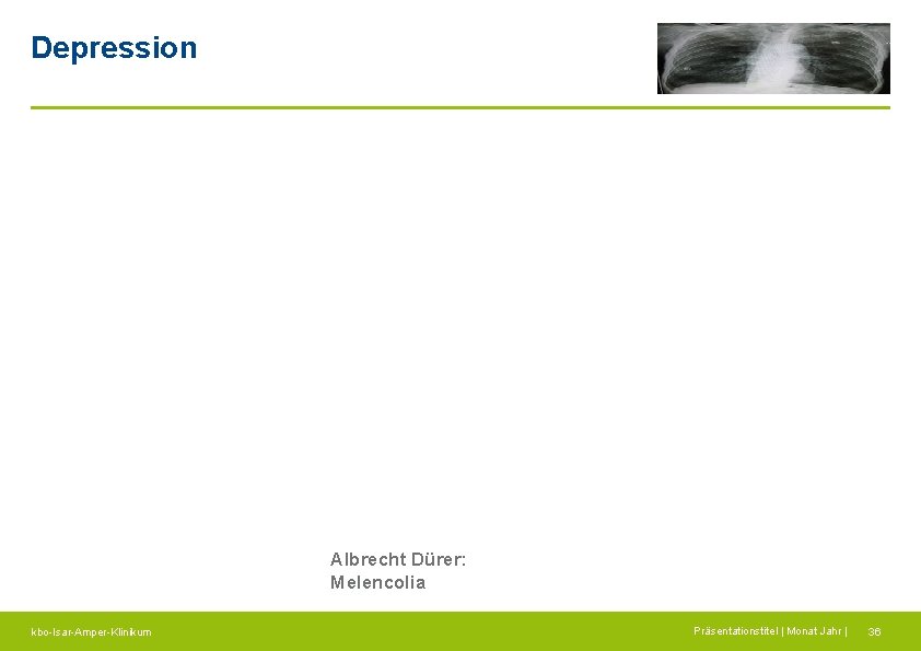 Depression Albrecht Dürer: Melencolia kbo-Isar-Amper-Klinikum Präsentationstitel | Monat Jahr | 36 