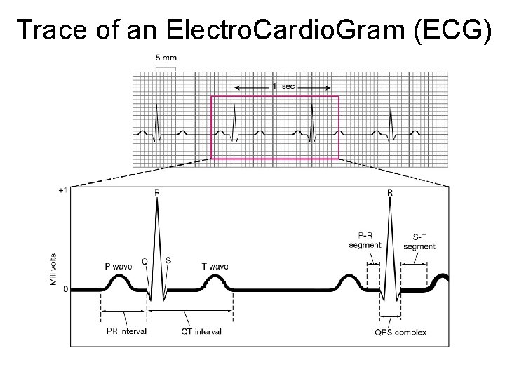 Trace of an Electro. Cardio. Gram (ECG) 