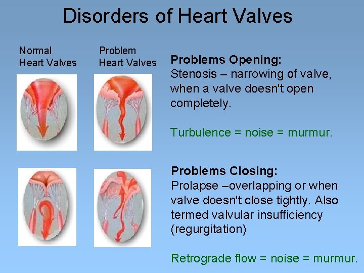 Disorders of Heart Valves Normal Heart Valves Problems Opening: Stenosis – narrowing of valve,