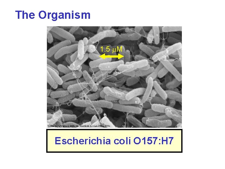 The Organism THE ORGANISM 1. 5 m. M Escherichia coli O 157: H 7