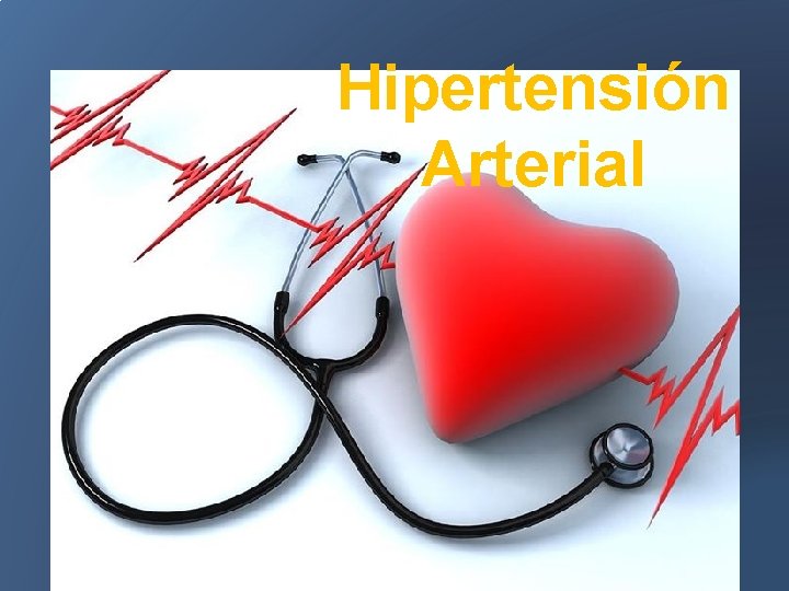 Hipertensión Arterial 