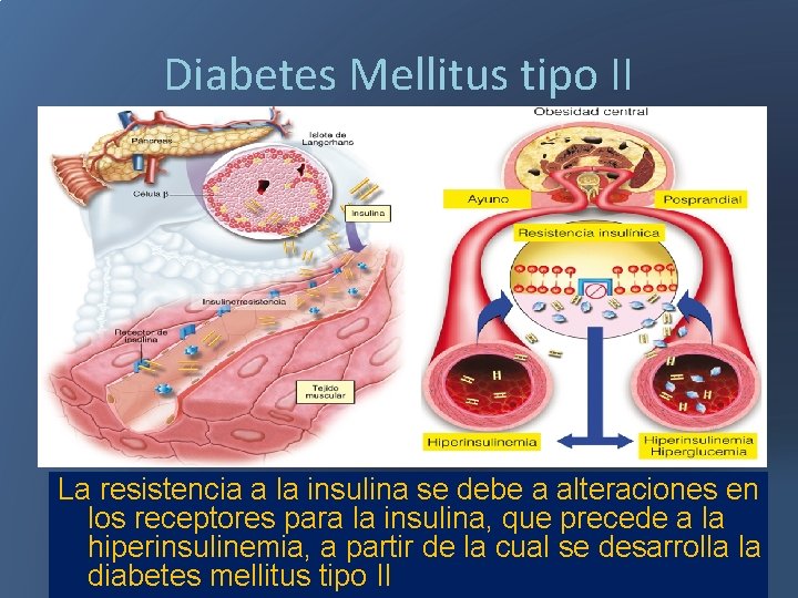 Diabetes Mellitus tipo II La resistencia a la insulina se debe a alteraciones en