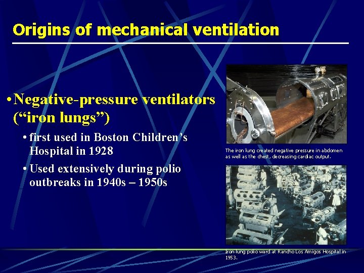 Origins of mechanical ventilation • Negative-pressure ventilators (“iron lungs”) • first used in Boston