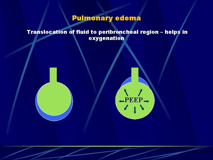 Pulmonary edema Translocation of fluid to peribroncheal region – helps in oxygenation PEEP 