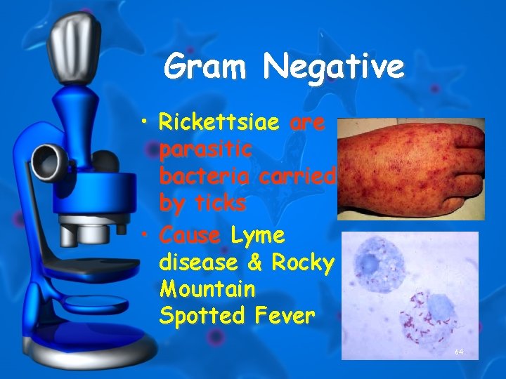 Gram Negative • Rickettsiae are parasitic bacteria carried by ticks • Cause Lyme disease