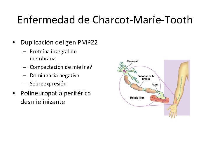Enfermedad de Charcot-Marie-Tooth • Duplicación del gen PMP 22 – Proteína integral de membrana