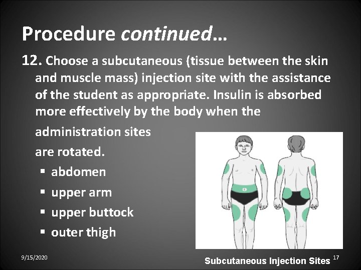 Procedure continued… 12. Choose a subcutaneous (tissue between the skin and muscle mass) injection