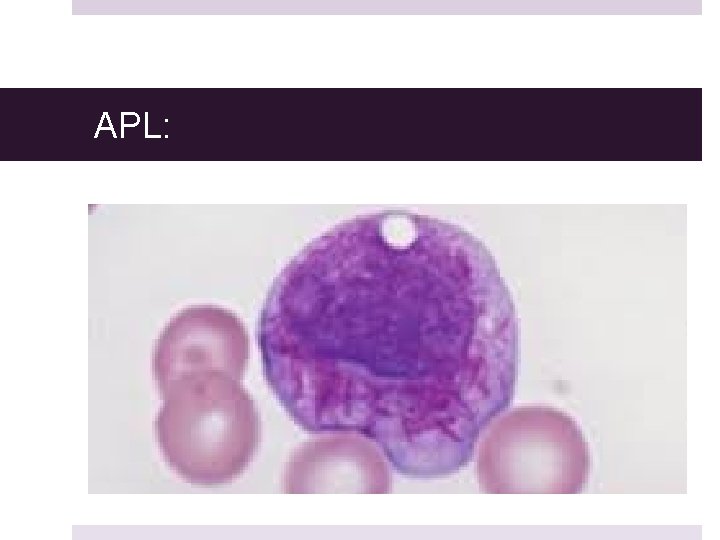 APL: APL: