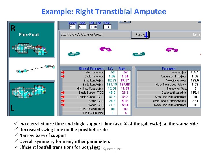 Example: Right Transtibial Amputee R Flex-Foot L ü Increased stance time and single support