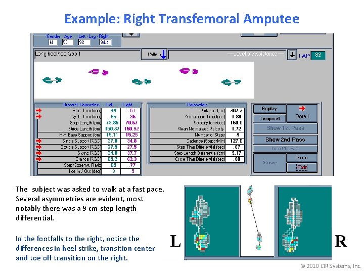 Example: Right Transfemoral Amputee The subject was asked to walk at a fast pace.