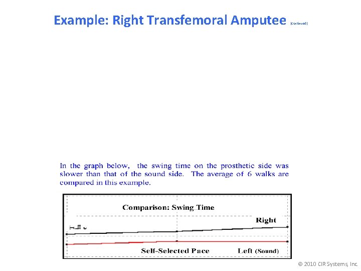 Example: Right Transfemoral Amputee (Continued) © 2010 CIR Systems, Inc. 