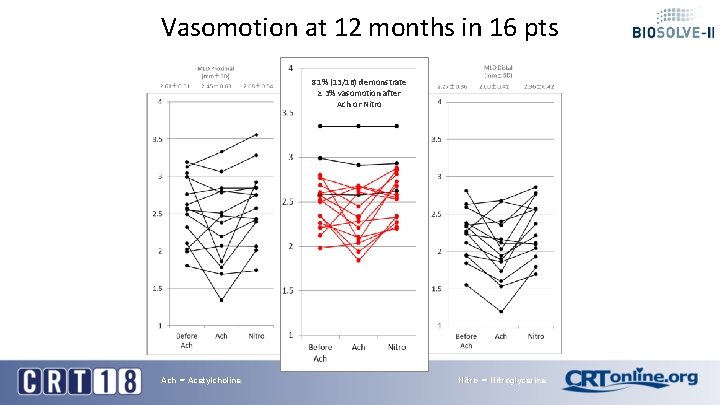 Vasomotion at 12 months in 16 pts 81% (13/16) demonstrate ≥ 3% vasomotion after